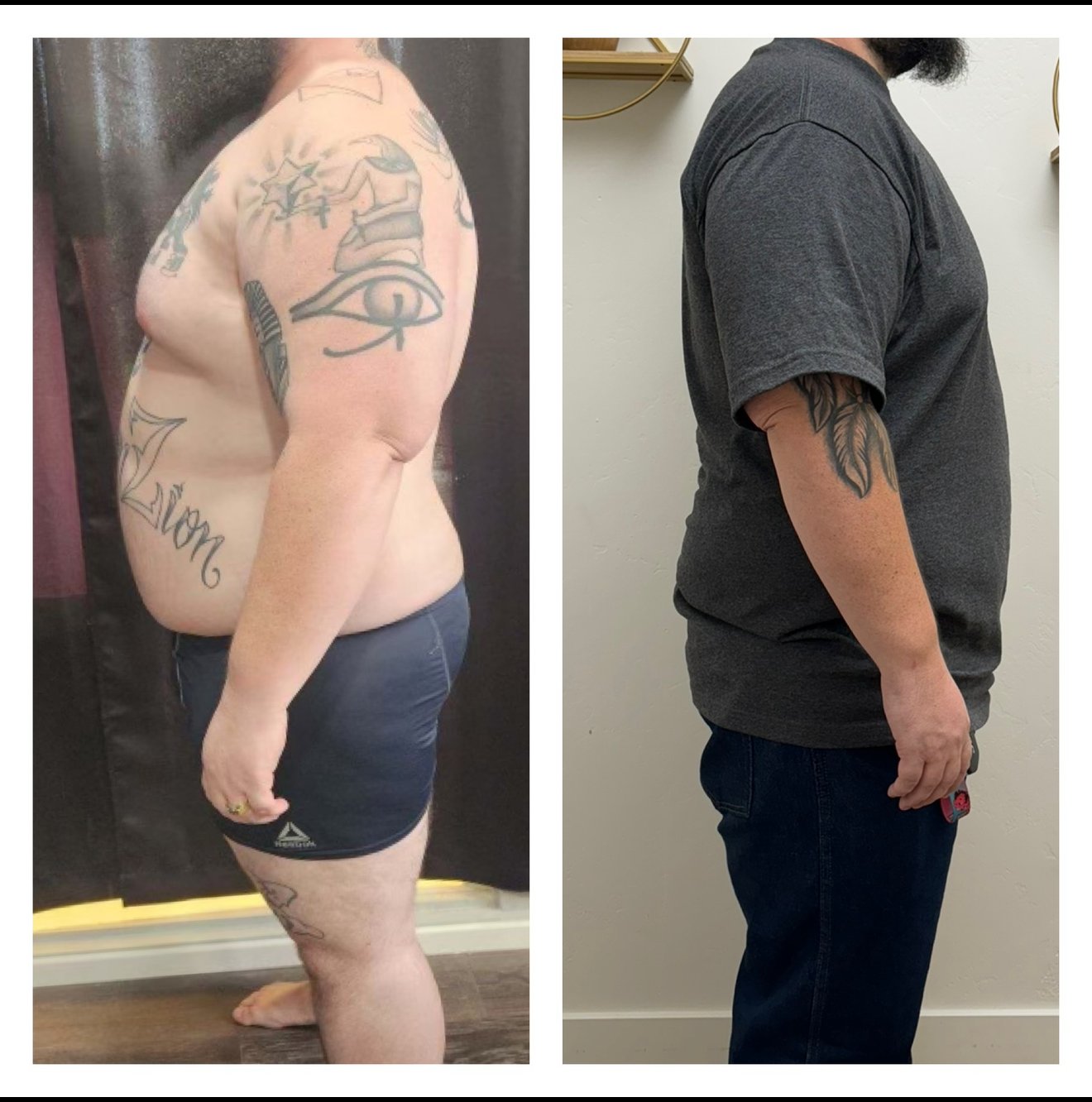 Body Shoppe male client GLP-1 weight loss before and after side profile